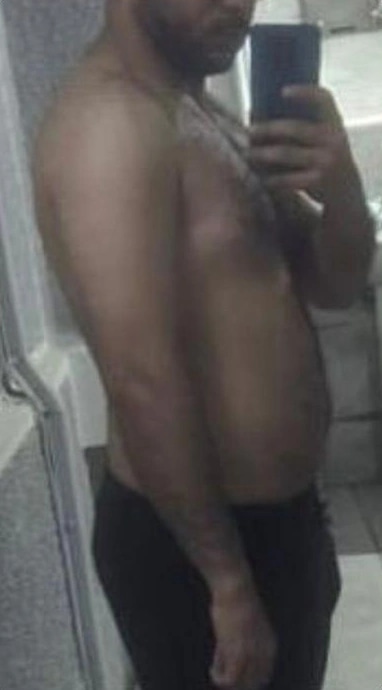 The same client fifteen weeks later, side view at 78 kg