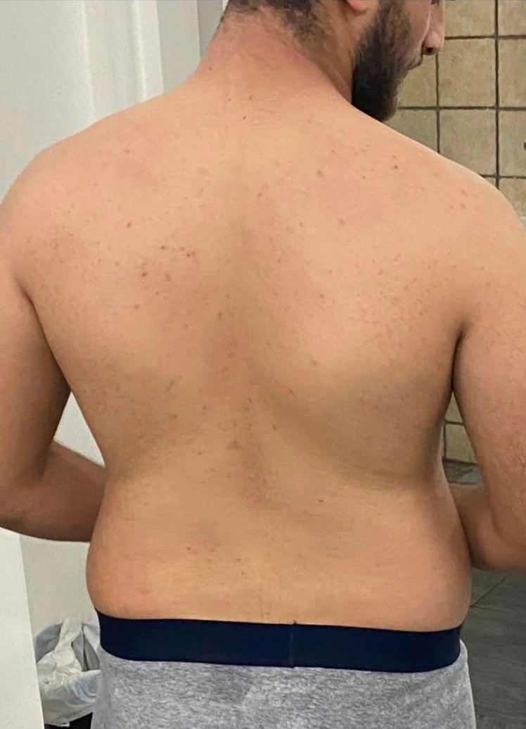 Ramez Asaad's back, before